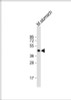 Western Blot at 1:2000 dilution + mouse stomach lysate Lysates/proteins at 20 ug per lane.