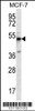 Western blot analysis in MCF-7 cell line lysates (35ug/lane) .