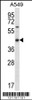 Western blot analysis in A549 cell line lysates (35ug/lane) .