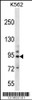 Western blot analysis in K562 cell line lysates (35ug/lane) .