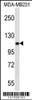 Western blot analysis in MDA-MB231 cell line lysates (35ug/lane) .