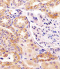 Antibody staining PCCA in human kidney tissue sections by Immunohistochemistry (IHC-P - paraformaldehyde-fixed, paraffin-embedded sections) .