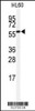 Western blot analysis of anti-SENP2 Antibody in HL60 cell line lysates (35ug/lane) .