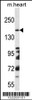 Western blot analysis in mouse heart tissue lysates (35ug/lane) .