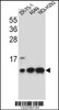 Western blot analysis in ZR-75-1, A549, NCI-H292 cell line lysates (35ug/lane) .