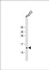 Western Blot at 1:1000 dilution + HepG2 whole cell lysate Lysates/proteins at 20 ug per lane.