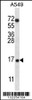 Western blot analysis in A549 cell line lysates (35ug/lane) .