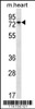 Western blot analysis in mouse heart tissue lysates (35ug/lane) .