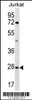 Western blot analysis in Jurkat cell line lysates (35ug/lane) .