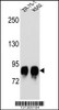 Western blot analysis in ZR-75-1, K562 cell line lysates (35ug/lane) .