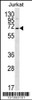 Western blot analysis in Jurkat cell line lysates (35ug/lane) .