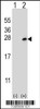 Western blot analysis of Dok5 using rabbit polyclonal Dok5 Antibody (PTB domain) using 293 cell lysates (2 ug/lane) either nontransfected (Lane 1) or transiently transfected (Lane 2) with the Dok5 gene.