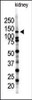 Western blot analysis of SENP7 polyclonal antibody in mouse kidney tissue lysate (35ug/lane) .