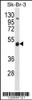 Western blot analysis in SK-BR-3 cell line lysates (35ug/lane) .