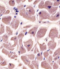 Antibody staining MYBPC3 in human heart tissue sections by Immunohistochemistry (IHC-P - paraformaldehyde-fixed, paraffin-embedded sections) .