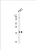 Western blot analysis of lysate from K562 cell line, using RNF5 Antibody at 1:1000 at each lane.