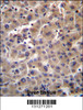 GUSB Antibody immunohistochemistry analysis in formalin fixed and paraffin embedded human liver tissue followed by peroxidase conjugation of the secondary antibody and DAB staining.