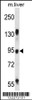 Western blot analysis in mouse liver tissue lysates (35ug/lane) .