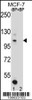 Western blot analysis of HIPK1 Antibody Pab pre-incubated without (lane 1) and with (lane 2) blocking peptide in MCF-7 cell line lysate.