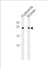 Western blot analysis in human placenta and mouse brain tissue lysates (35ug/lane) .