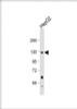 Western Blot at 1:1000 dilution + HepG2 whole cell lysate Lysates/proteins at 20 ug per lane.