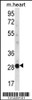 Western blot analysis in mouse heart tissue lysates (35ug/lane) .