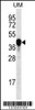 Western blot analysis in uterus tumor cell line lysates (35ug/lane) .