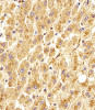 Antibody staining GAA in Human liver tissue sections by Immunohistochemistry (IHC-P - paraformaldehyde-fixed, paraffin-embedded sections) .