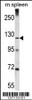 Western blot analysis in mouse spleen tissue lysates (35ug/lane) .