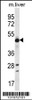 Western blot analysis in mouse liver tissue lysates (35ug/lane) .