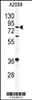 Western blot analysis of APEH antibody in A2058 cell line lysates (35ug/lane)