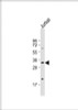 Western Blot at 1:500 dilution + Jurkat whole cell lysate Lysates/proteins at 20 ug per lane.