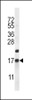 Western blot analysis in mouse heart tissue lysates (35ug/lane) .