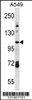 Western blot analysis in A549 cell line lysates (35ug/lane) .