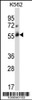 Western blot analysis in K562 cell line lysates (35ug/lane) .