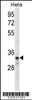 Western blot analysis in Hela cell line lysates (35ug/lane) .