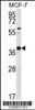 Western blot analysis in MCF-7 cell line lysates (35ug/lane) .