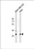 Western Blot at 1:2000 dilution Lane 1: MDA-MB-453 whole cell lysate Lane 2: Hela whole cell lysate Lysates/proteins at 20 ug per lane.