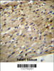 ABCD2 Antibody immunohistochemistry analysis in formalin fixed and paraffin embedded human heart tissue followed by peroxidase conjugation of the secondary antibody and DAB staining.
