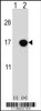 Western blot analysis of CDKN2B using rabbit polyclonal CDKN2B Antibody using 293 cell lysates (2 ug/lane) either nontransfected (Lane 1) or transiently transfected (Lane 2) with the CDKN2B gene.