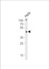 Western blot analysis of lysate from Hela cell line, using TRIP13 Antibody at 1:1000 at each lane.