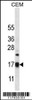 Western blot analysis in CEM cell line lysates (35ug/lane) .This demonstrates the MRPS12 antibody detected the MRPS12 protein (arrow) .