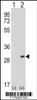 Western blot analysis of DPT using rabbit polyclonal DPT Antibody using 293 cell lysates (2 ug/lane) either nontransfected (Lane 1) or transiently transfected (Lane 2) with the DPT gene.