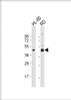 Western Blot at 1:1000 dilution Lane 1: HL-60 whole cell lysate Lane 2: RD whole cell lysate Lysates/proteins at 20 ug per lane.