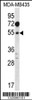 Western blot analysis in MDA-MB435 cell line lysates (35ug/lane) .