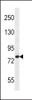 Western blot analysis in MDA-MB231 cell line lysates (35ug/lane) .