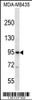 Western blot analysis in MDA-MB435 cell line lysates (35ug/lane) .