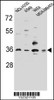 Western blot analysis in NCI-H292, A549, WiDr, MDA-MB453 cell line lysates (35ug/lane) .
