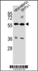 Western blot analysis in MDA-MB453, ZR-75-1 cell line lysates (35ug/lane) .