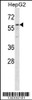 Western blot analysis in HepG2 cell line lysates (35ug/lane) .